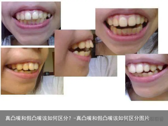 真凸嘴和假凸嘴该如何区分？-真凸嘴和假凸嘴该如何区分图片