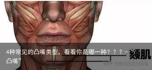 4种常见的凸嘴类型，看看你是哪一种？？？-“凸嘴”