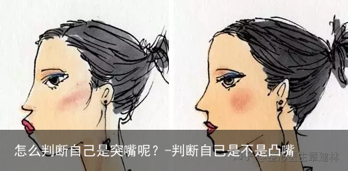 怎么判断自己是突嘴呢？-判断自己是不是凸嘴