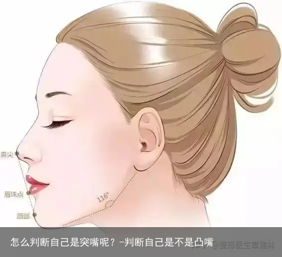 怎么判断自己是突嘴呢？-判断自己是不是凸嘴