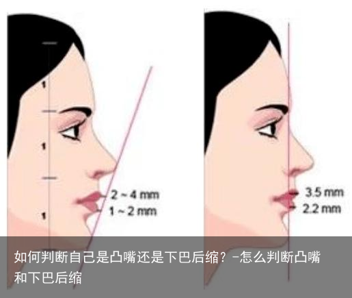 如何判断自己是凸嘴还是下巴后缩？-怎么判断凸嘴和下巴后缩