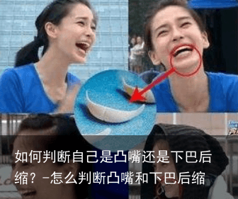 如何判断自己是凸嘴还是下巴后缩？-怎么判断凸嘴和下巴后缩