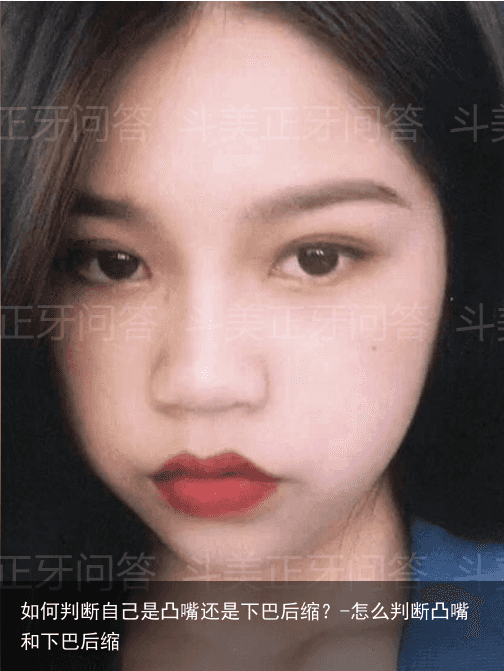 如何判断自己是凸嘴还是下巴后缩？-怎么判断凸嘴和下巴后缩