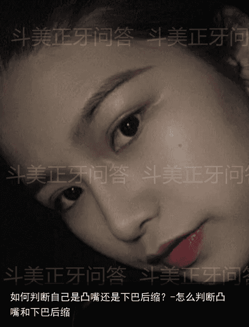 如何判断自己是凸嘴还是下巴后缩？-怎么判断凸嘴和下巴后缩
