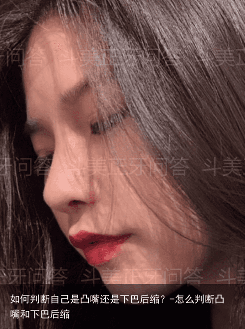 如何判断自己是凸嘴还是下巴后缩？-怎么判断凸嘴和下巴后缩