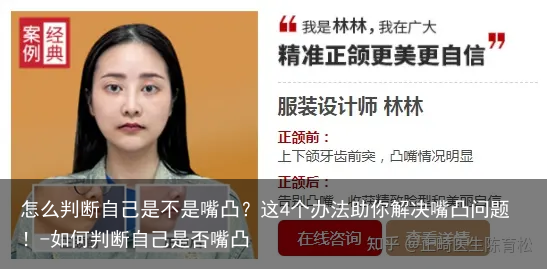 怎么判断自己是不是嘴凸？这4个办法助你解决嘴凸问题！-如何判断自己是否嘴凸