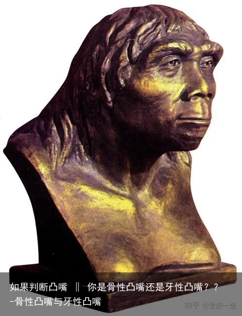 如果判断凸嘴 ‖ 你是骨性凸嘴还是牙性凸嘴？？-骨性凸嘴与牙性凸嘴