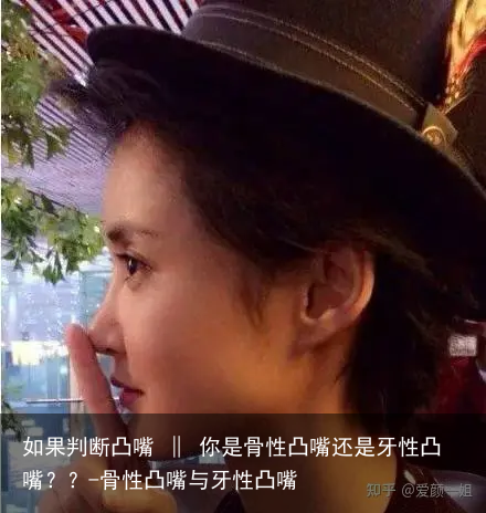 如果判断凸嘴 ‖ 你是骨性凸嘴还是牙性凸嘴？？-骨性凸嘴与牙性凸嘴