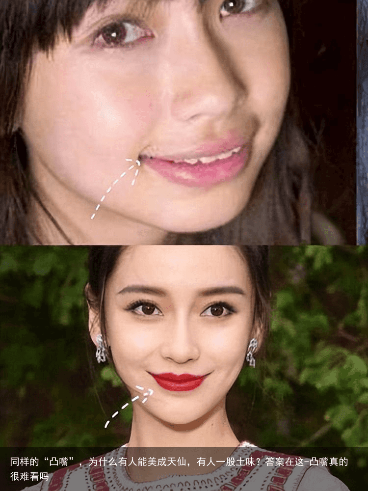同样的“凸嘴”，为什么有人能美成天仙，有人一股土味？答案在这-凸嘴真的很难看吗
