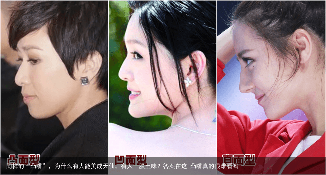 同样的“凸嘴”，为什么有人能美成天仙，有人一股土味？答案在这-凸嘴真的很难看吗