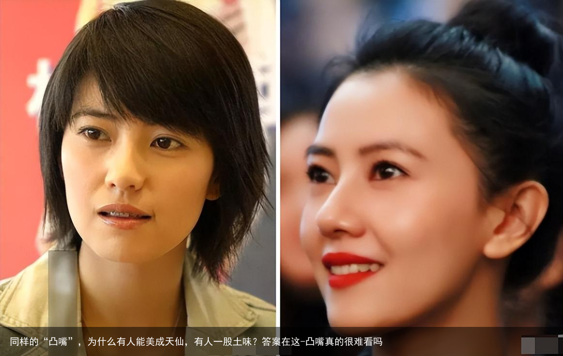 同样的“凸嘴”，为什么有人能美成天仙，有人一股土味？答案在这-凸嘴真的很难看吗