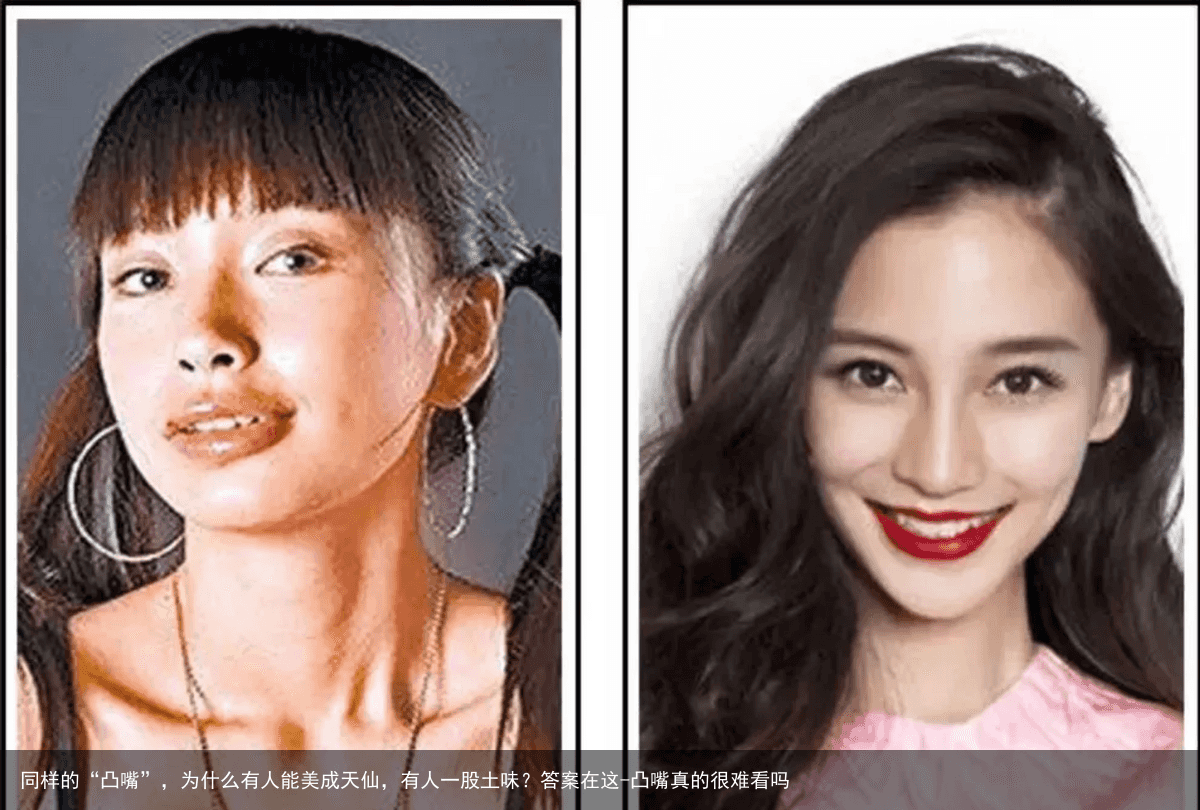 同样的“凸嘴”，为什么有人能美成天仙，有人一股土味？答案在这-凸嘴真的很难看吗