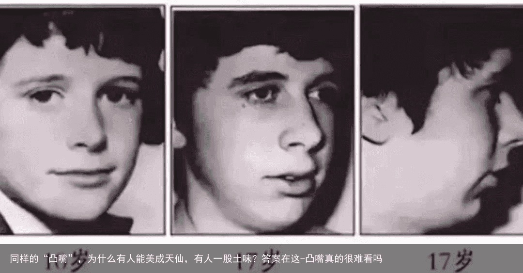 同样的“凸嘴”，为什么有人能美成天仙，有人一股土味？答案在这-凸嘴真的很难看吗