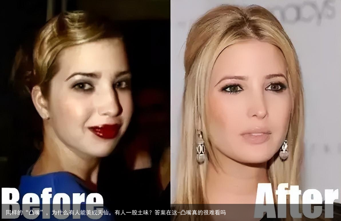 同样的“凸嘴”，为什么有人能美成天仙，有人一股土味？答案在这-凸嘴真的很难看吗