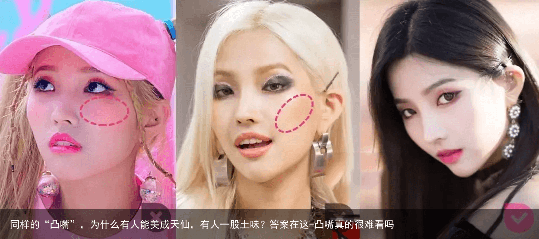 同样的“凸嘴”，为什么有人能美成天仙，有人一股土味？答案在这-凸嘴真的很难看吗