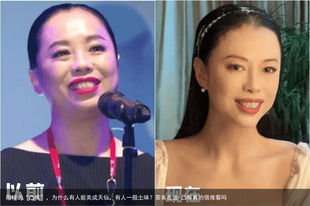 同样的“凸嘴”，为什么有人能美成天仙，有人一股土味？答案在这-凸嘴真的很难看吗