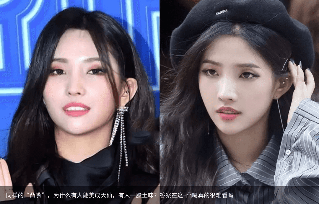 同样的“凸嘴”，为什么有人能美成天仙，有人一股土味？答案在这-凸嘴真的很难看吗