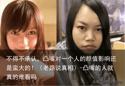 不得不承认，凸嘴对一个人的颜值影响还是蛮大的！（老路说真相）-凸嘴的人就真的难看吗