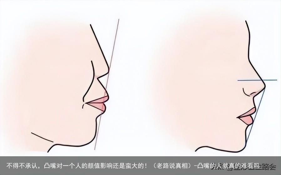 不得不承认，凸嘴对一个人的颜值影响还是蛮大的！（老路说真相）-凸嘴的人就真的难看吗