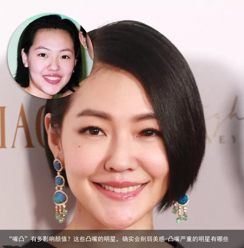 “嘴凸”有多影响颜值？这些凸嘴的明星，确实会削弱美感-凸嘴严重的明星有哪些