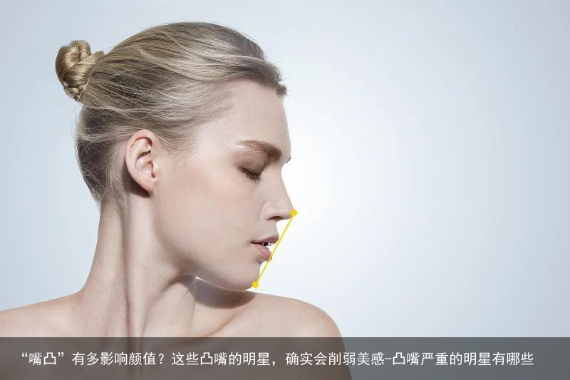 “嘴凸”有多影响颜值？这些凸嘴的明星，确实会削弱美感-凸嘴严重的明星有哪些