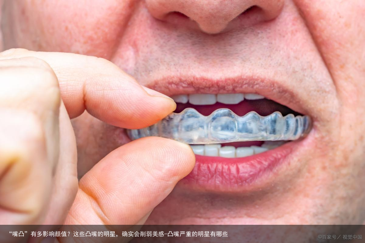 “嘴凸”有多影响颜值？这些凸嘴的明星，确实会削弱美感-凸嘴严重的明星有哪些