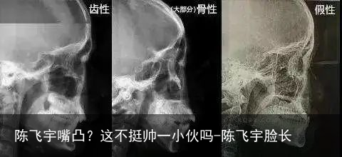 陈飞宇嘴凸？这不挺帅一小伙吗-陈飞宇脸长