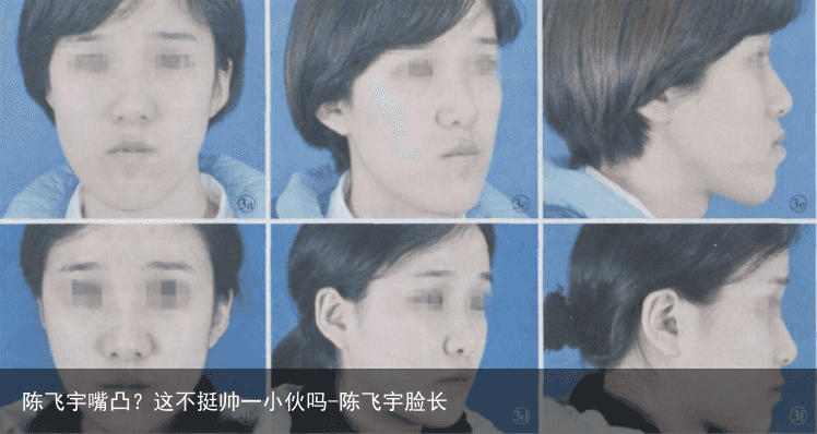 陈飞宇嘴凸？这不挺帅一小伙吗-陈飞宇脸长