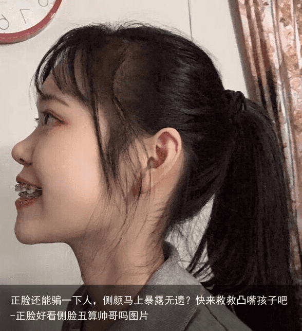 正脸还能骗一下人，侧颜马上暴露无遗？快来救救凸嘴孩子吧-正脸好看侧脸丑算帅哥吗图片