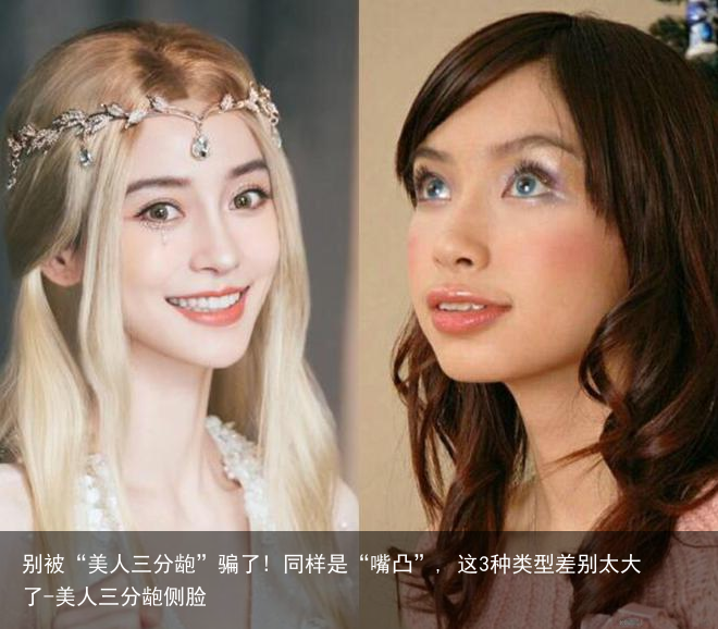 别被“美人三分龅”骗了! 同样是“嘴凸”, 这3种类型差别太大了-美人三分龅侧脸