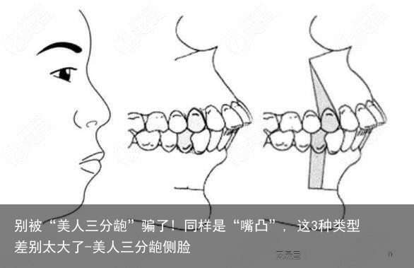 别被“美人三分龅”骗了! 同样是“嘴凸”, 这3种类型差别太大了-美人三分龅侧脸