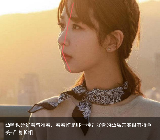 凸嘴也分好看与难看，看看你是哪一种？好看的凸嘴其实很有特色美-凸嘴长相