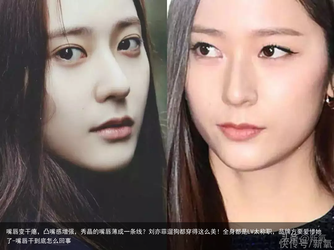 嘴唇变干瘪，凸嘴感增强，秀晶的嘴唇薄成一条线？刘亦菲遛狗都穿得这么美！全身都是LV太称职，品牌方要爱惨她了-嘴唇干到底怎么回事