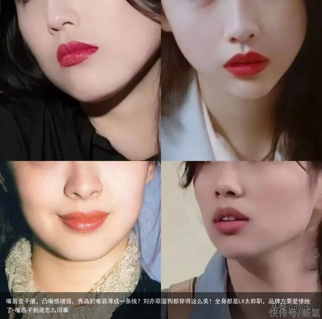 嘴唇变干瘪，凸嘴感增强，秀晶的嘴唇薄成一条线？刘亦菲遛狗都穿得这么美！全身都是LV太称职，品牌方要爱惨她了-嘴唇干到底怎么回事