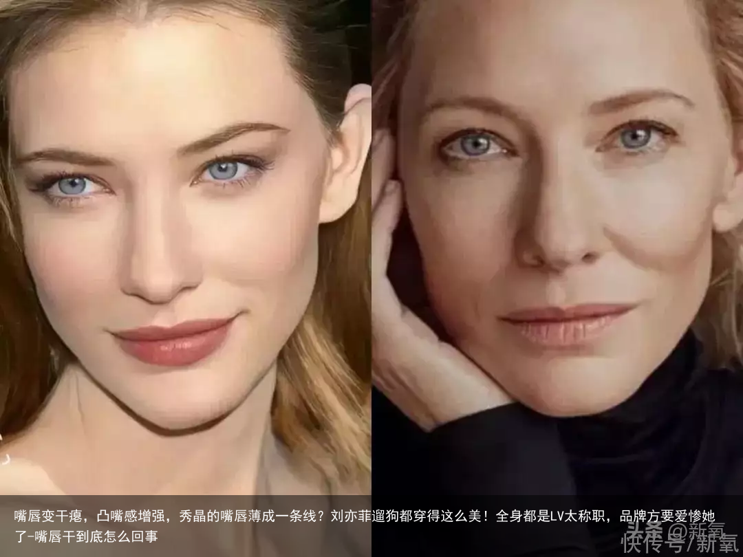 嘴唇变干瘪，凸嘴感增强，秀晶的嘴唇薄成一条线？刘亦菲遛狗都穿得这么美！全身都是LV太称职，品牌方要爱惨她了-嘴唇干到底怎么回事