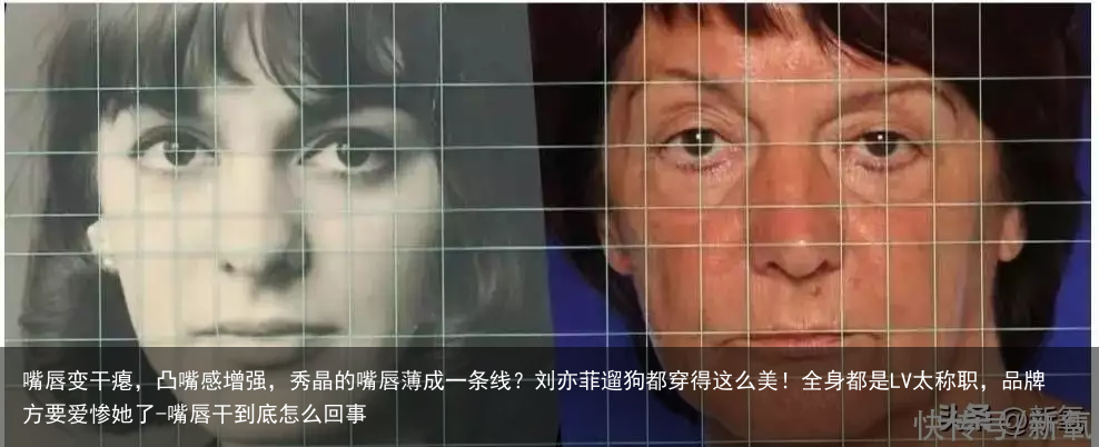 嘴唇变干瘪，凸嘴感增强，秀晶的嘴唇薄成一条线？刘亦菲遛狗都穿得这么美！全身都是LV太称职，品牌方要爱惨她了-嘴唇干到底怎么回事