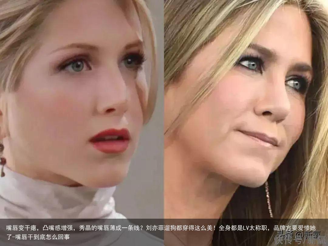 嘴唇变干瘪，凸嘴感增强，秀晶的嘴唇薄成一条线？刘亦菲遛狗都穿得这么美！全身都是LV太称职，品牌方要爱惨她了-嘴唇干到底怎么回事