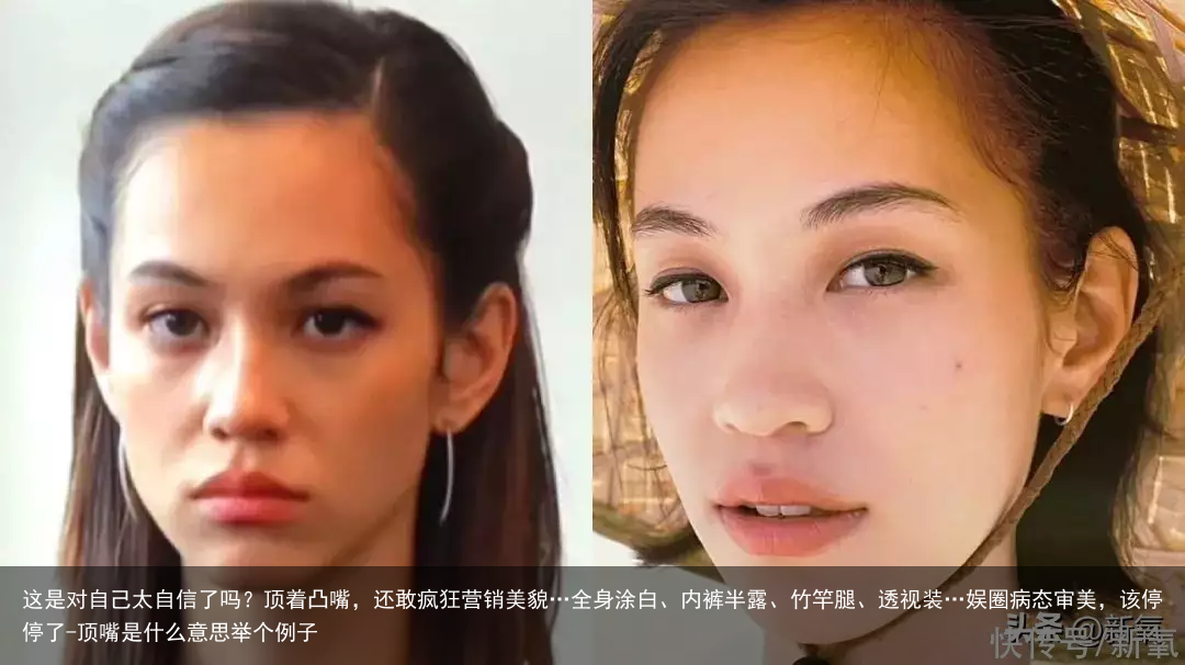 这是对自己太自信了吗？顶着凸嘴，还敢疯狂营销美貌…全身涂白、内裤半露、竹竿腿、透视装…娱圈病态审美，该停停了-顶嘴是什么意思举个例子