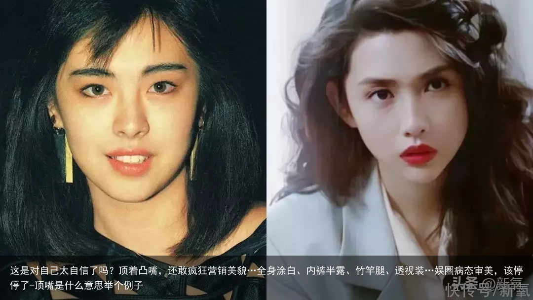 这是对自己太自信了吗？顶着凸嘴，还敢疯狂营销美貌…全身涂白、内裤半露、竹竿腿、透视装…娱圈病态审美，该停停了-顶嘴是什么意思举个例子