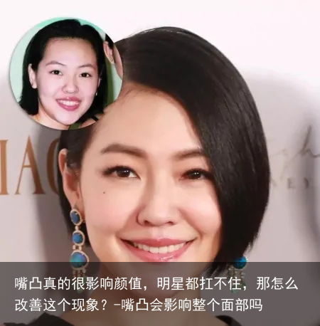 嘴凸真的很影响颜值，明星都扛不住，那怎么改善这个现象？-嘴凸会影响整个面部吗