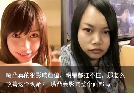 嘴凸真的很影响颜值，明星都扛不住，那怎么改善这个现象？-嘴凸会影响整个面部吗