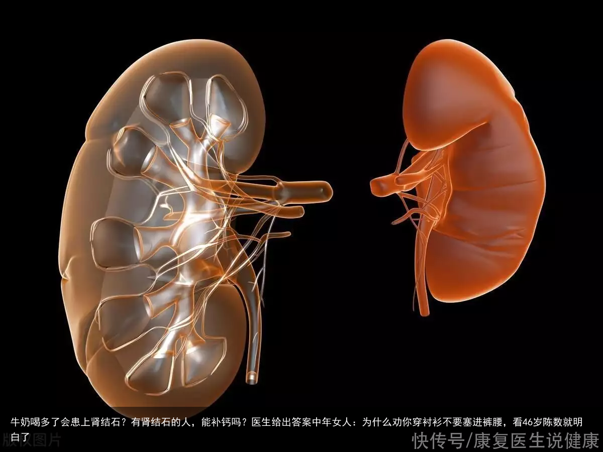 牛奶喝多了会患上肾结石？有肾结石的人，能补钙吗？医生给出答案