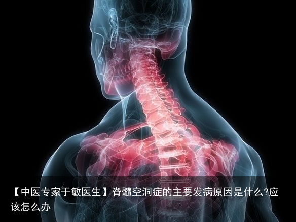 【中医专家于敏医生】脊髓空洞症的主要发病原因是什么?应该怎么办