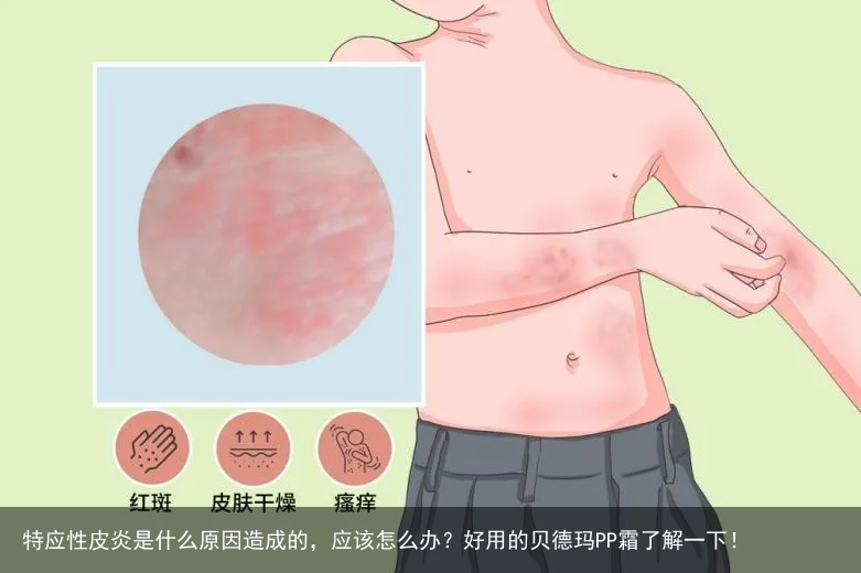 特应性皮炎是什么原因造成的，应该怎么办？好用的贝德玛PP霜了解一下！