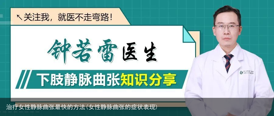 治疗女性静脉曲张最快的方法(女性静脉曲张的症状表现)