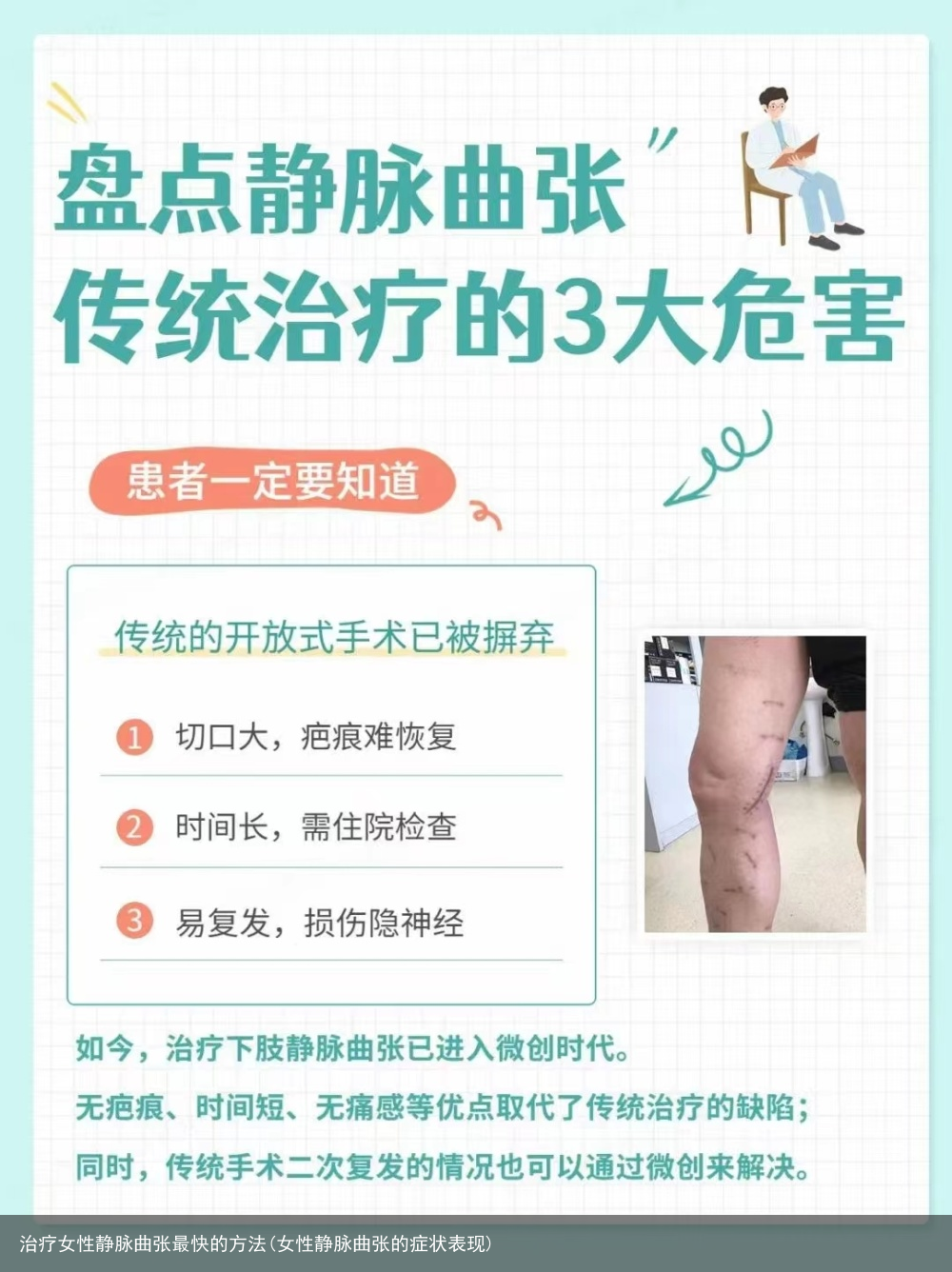 治疗女性静脉曲张最快的方法(女性静脉曲张的症状表现)