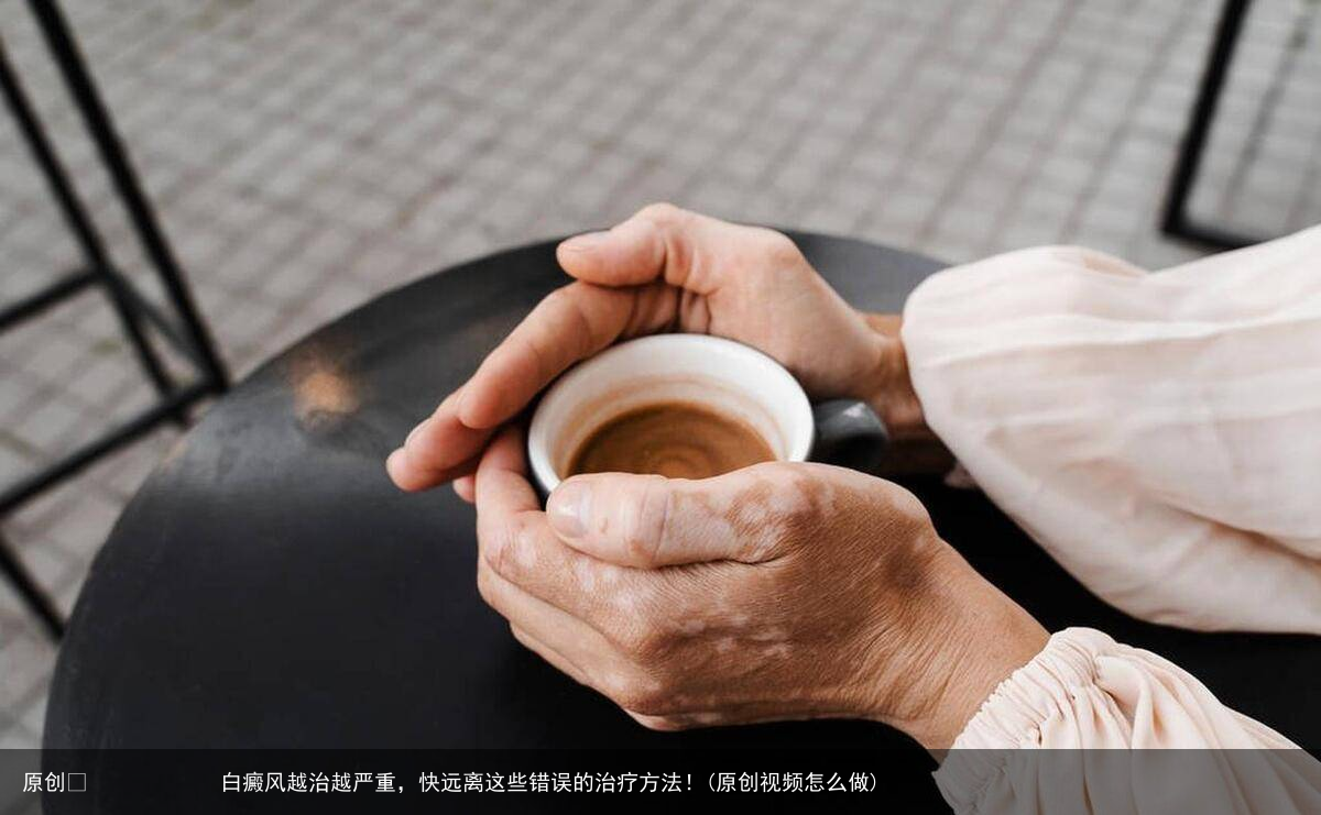 白癜风越治越严重，快远离这些错误的治疗方法！