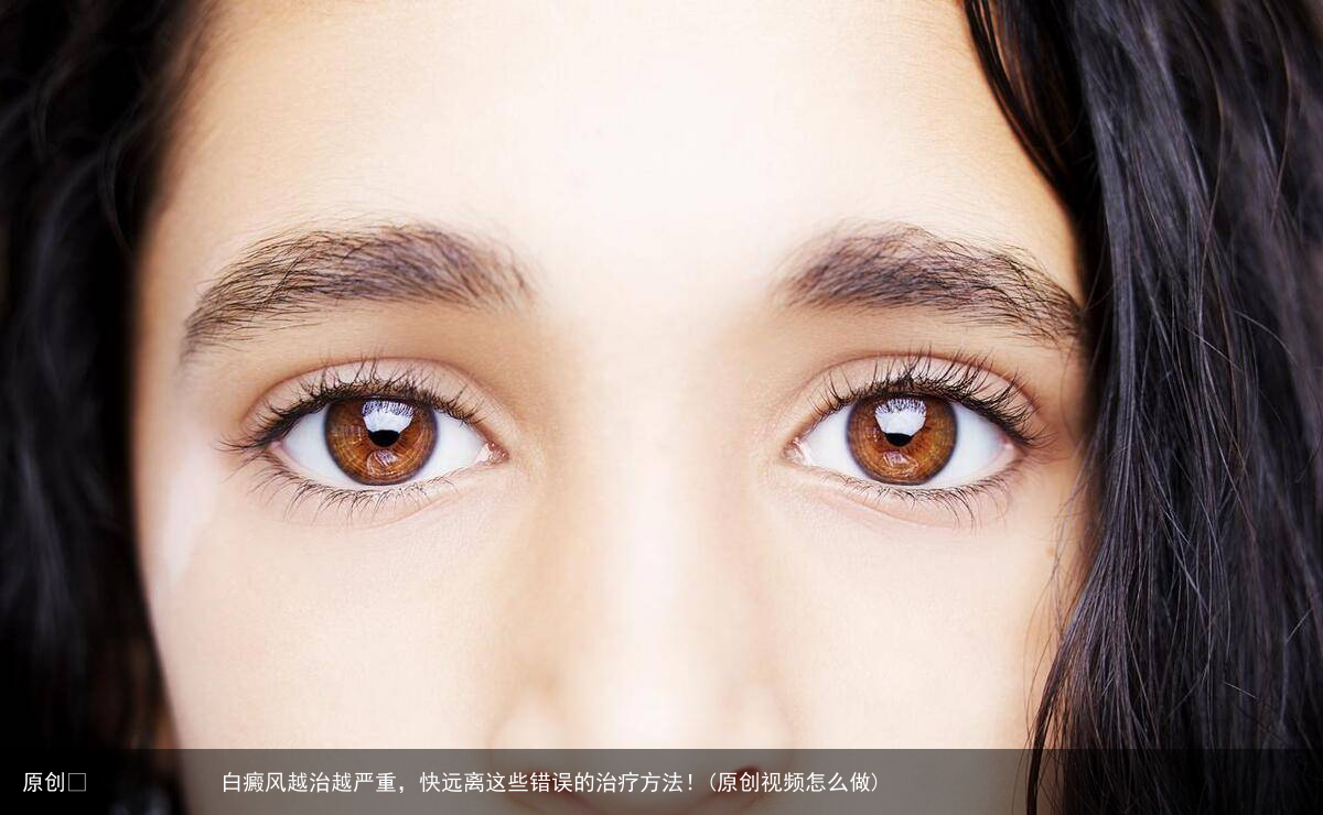 白癜风越治越严重，快远离这些错误的治疗方法！