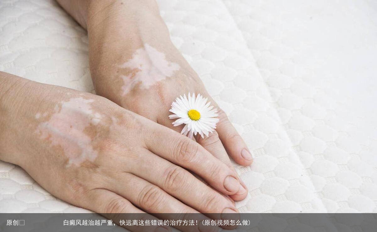 白癜风越治越严重，快远离这些错误的治疗方法！