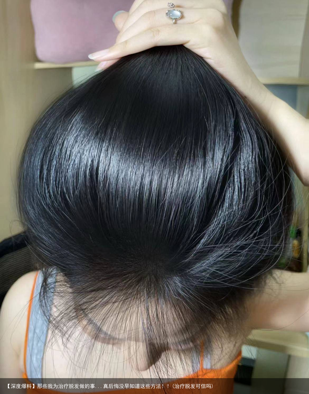 【深度爆料】那些我为治疗脱发做的事...真后悔没早知道这些方法！！(治疗脱发可信吗)